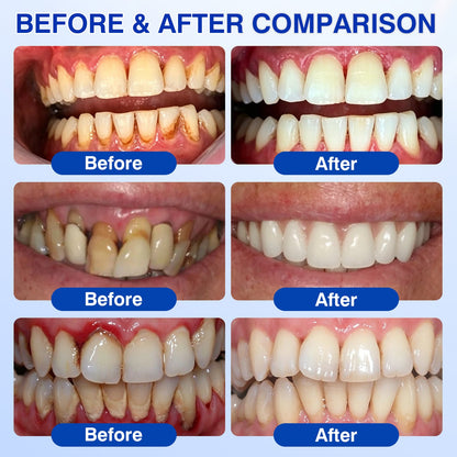 🇺🇸🏅🦷🛡️Natravor® GumRevive Periodontal Repair Gel