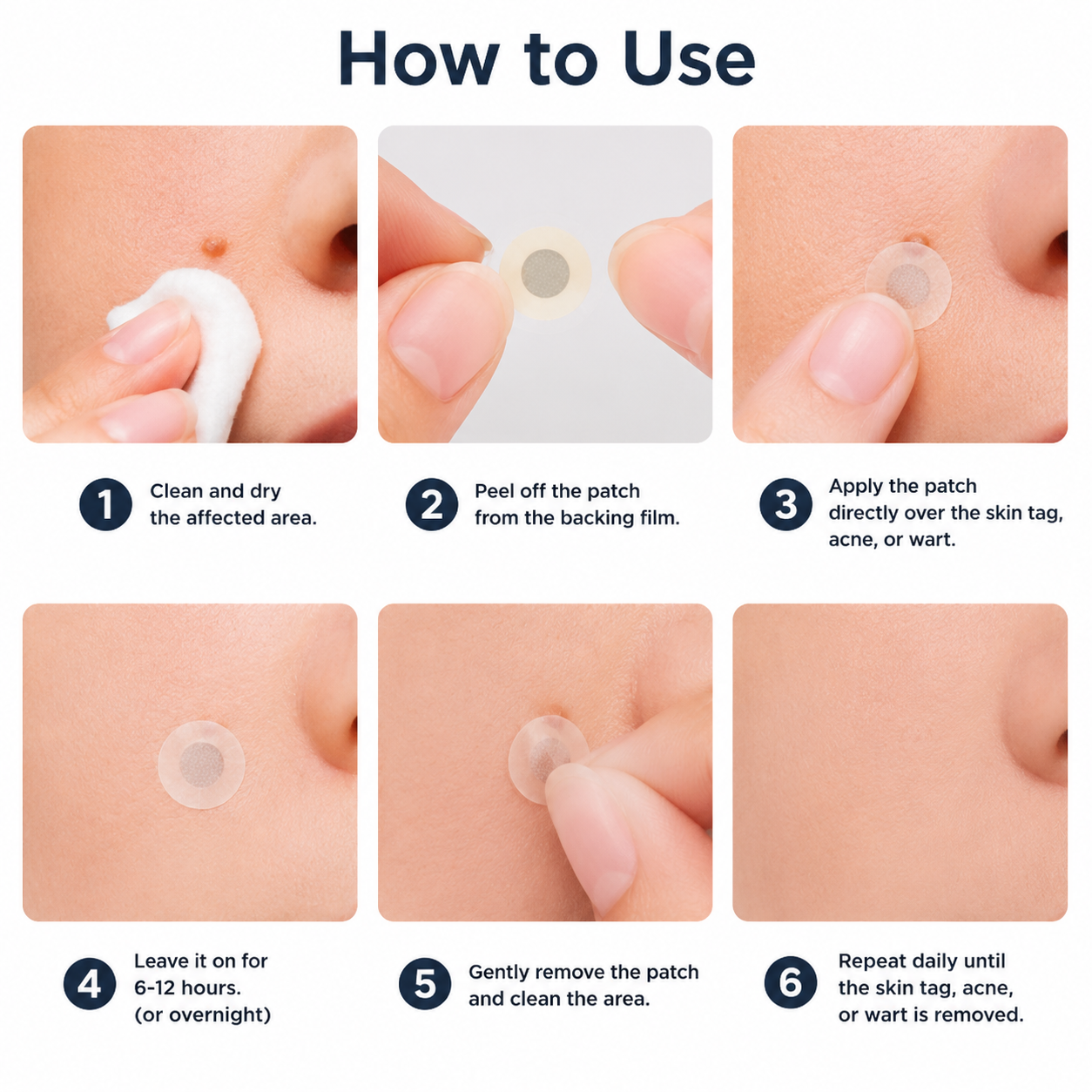 NATRAVOR® 2-in-1 Microneedle & Hydrocolloid Patch🍀| Removes Raised Moles, Acne, Flat Warts & Skin Tags | Helps Improve Wrinkles, Scars & Blemishes | Invisible Patches for Face & Body
