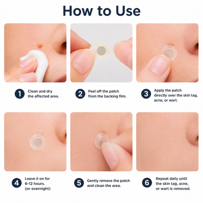 NATRAVOR® 2-in-1 Microneedle & Hydrocolloid Patch🍀| Removes Raised Moles, Acne, Flat Warts & Skin Tags | Helps Improve Wrinkles, Scars & Blemishes | Invisible Patches for Face & Body