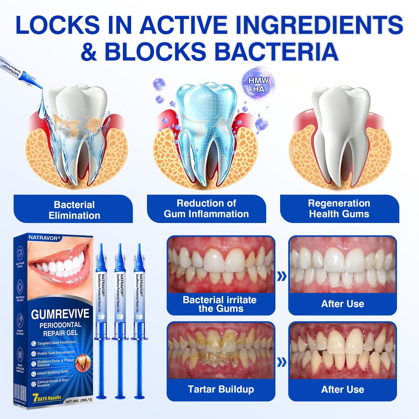 🇺🇸🏅🦷🛡️Natravor® GumRevive Periodontal Repair Gel