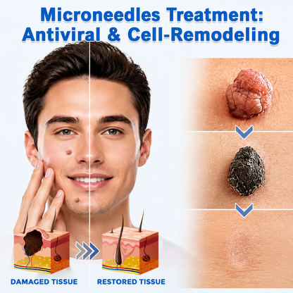 NATRAVOR® 2-in-1 Microneedle & Hydrocolloid Patch🍀| Removes Raised Moles, Acne, Flat Warts & Skin Tags | Helps Improve Wrinkles, Scars & Blemishes | Invisible Patches for Face & Body